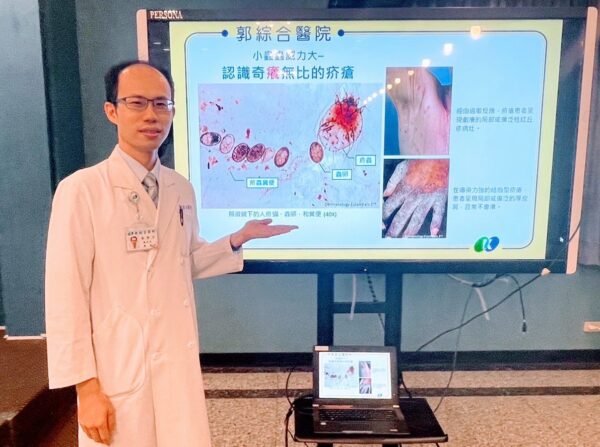 疥瘡傳染力強　皮膚科醫師提醒高風險族群注意